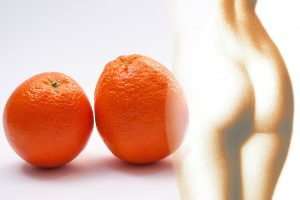 masaje anticelulitico piel de naranja